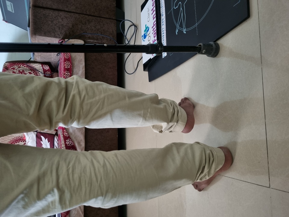 Limb Length Discrepancy